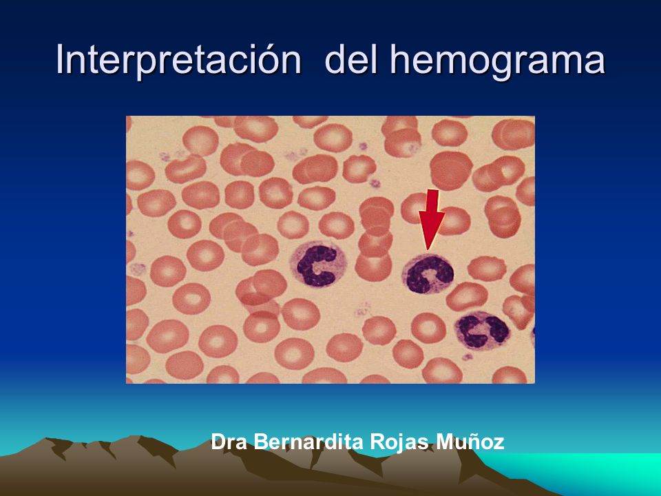 interpretacion de hemograma completo en perros